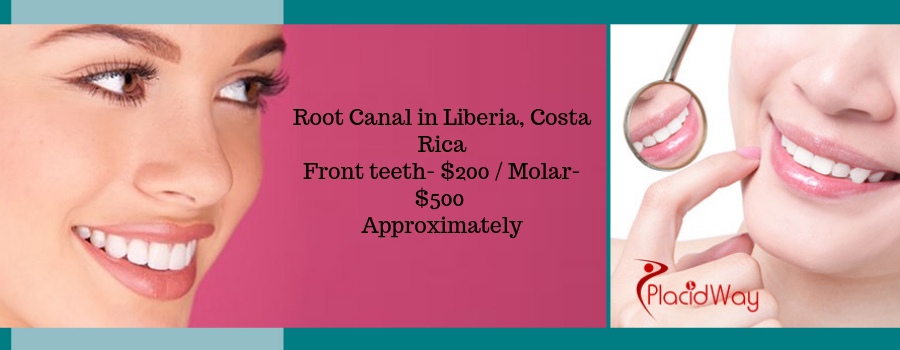 Root Canal in Liberia, Costa Rica